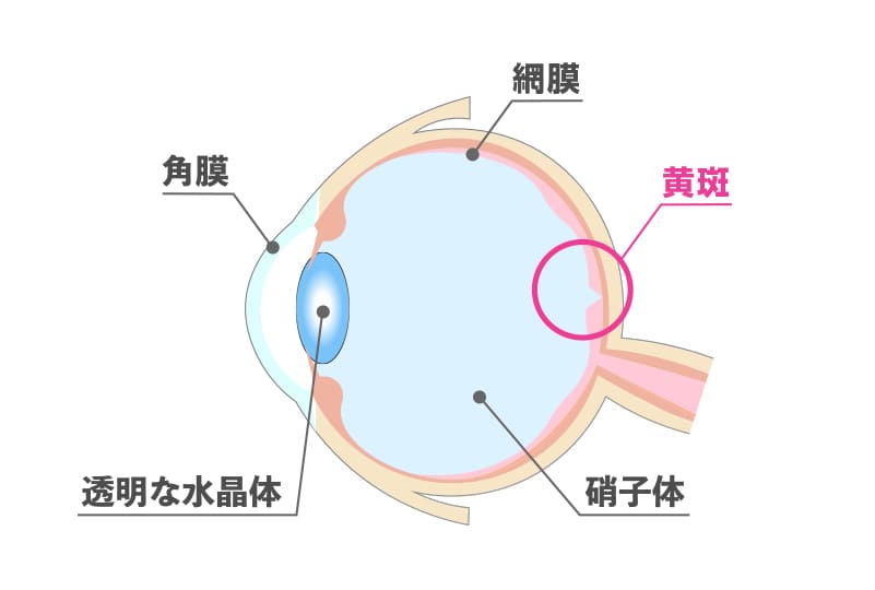 黄斑円孔