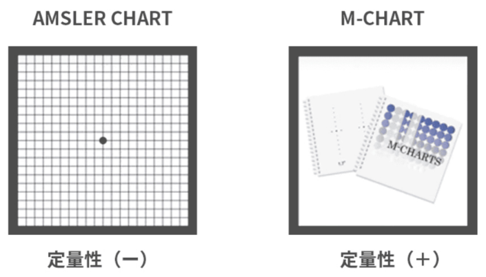 アムスラーチャートとMチャートイメージ図